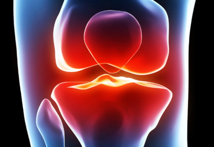 CRF-GO | Nova tecnologia permite regenerar cartilagem e pode mudar tratamentos ortopédicos