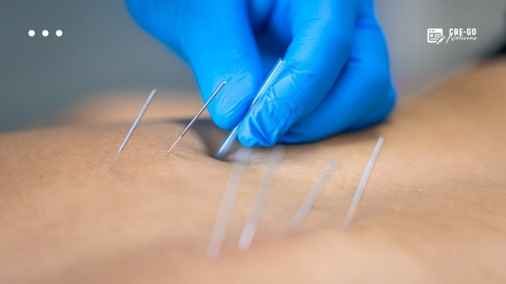 CRF-GO | Regulamentação da acupuntura avança no Senado e inclui o farmacêutico entre os profissionais habilitados