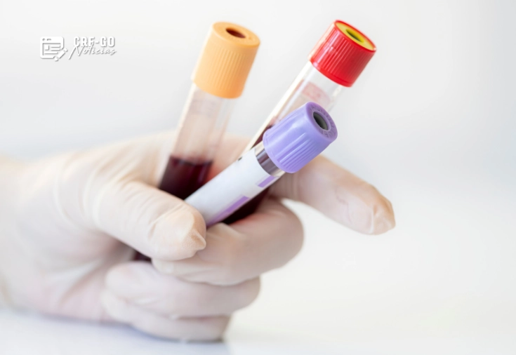 CRF-GO | Novo exame de sangue pode facilitar o diagnóstico do Alzheimer